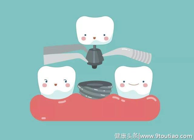 你的牙齿健康吗？这7个标准中有3项不达标，你就要去看医生了