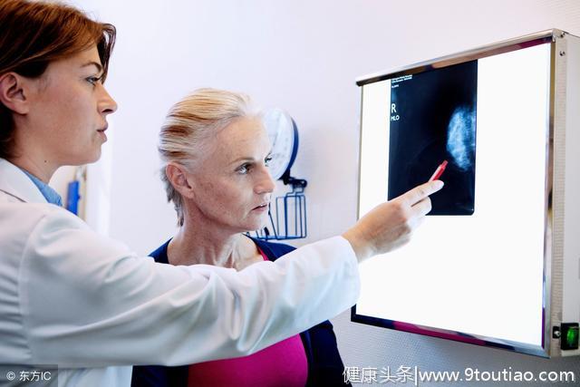 乳腺癌的发病与4个因素有关，及早防范才是重点