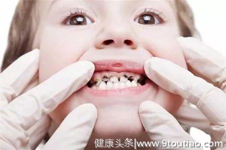 家长最怕遇到的，宝宝五大类牙齿问题排行榜！