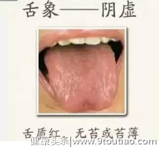 舌头是人体健康的“放大镜”，几种常见舌象的解决办法