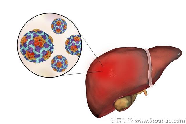 癌症也会传染？医生：当心这5种病毒，尽早发现，患癌几率会降低