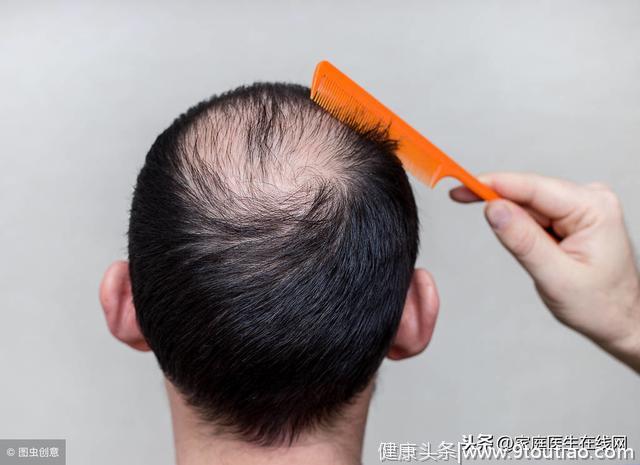 每6个中国人就有1个脱发！“脱发一族”该如何自救？送你一份指南