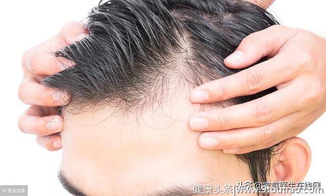 每6个中国人就有1个脱发！“脱发一族”该如何自救？送你一份指南
