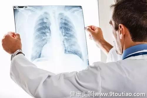 约50%的肺癌都与它有关，出现4种症状要当心！