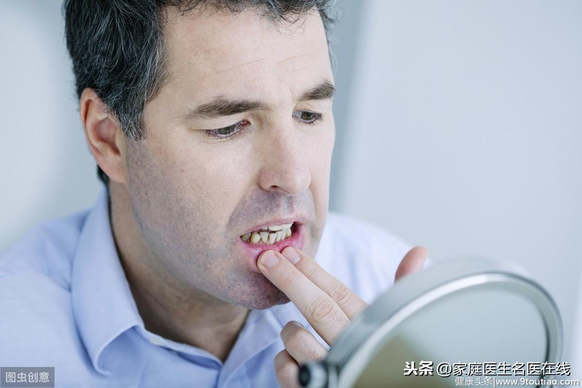 口腔黏膜有异常，4种病尤为常见！快对照看看，你中招了没？