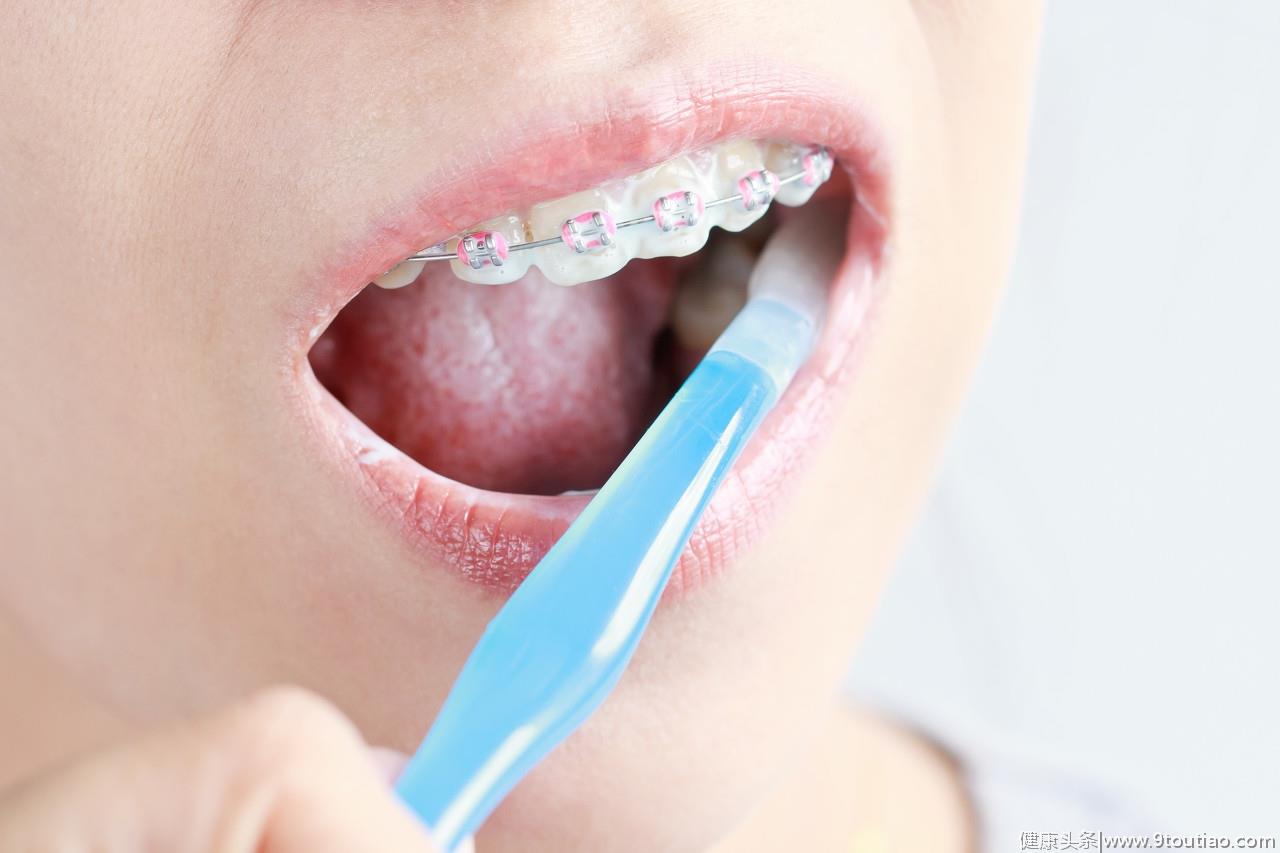 预防蛀牙除了刷牙外还有什么？坚持做好这6件事，还你健康牙齿