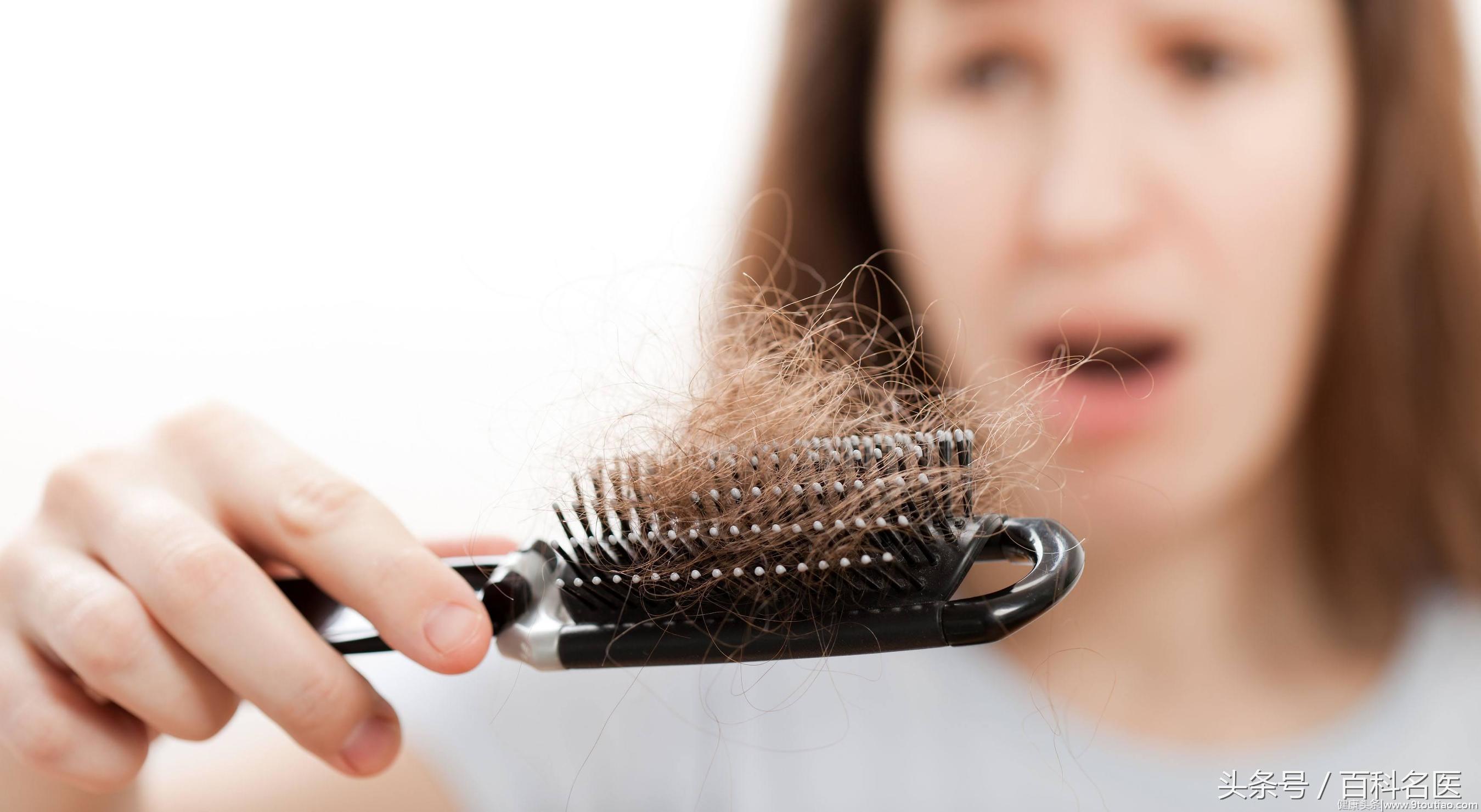 如果你觉得自己脱发了，不妨看看这篇文章！4种方法教你告别脱发