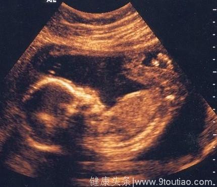 九大怪异怀孕现象 男婴会在子宫里勃起？！