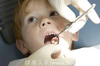 儿童蛀牙频发 除了吃糖还有这些原因 你家宝宝有这些情况吗？