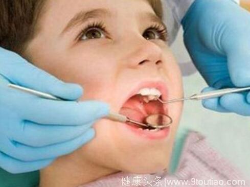 宝宝蛀牙疼痛怎么缓解？多让孩子吃这些食物可以预防蛀牙！