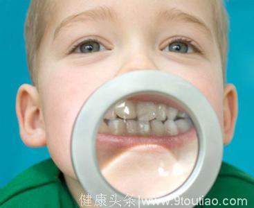 儿童须改掉的伤牙齿的坏习惯