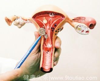 子宫肌瘤需要切除卵巢？