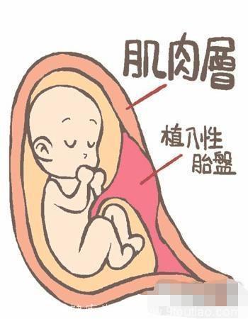 误信胎盘能治咳嗽，给两岁的孩子吃了一年胎盘，结果让妈妈很后悔