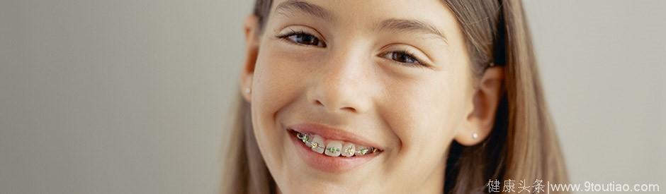 矫正牙齿什么年龄合适？
