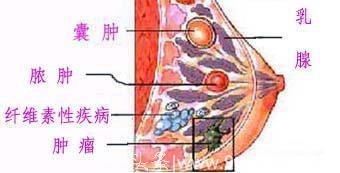 与乳房零距离