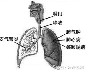 居家常用偏方集萃之呼吸系统疾病：慢性支气管炎