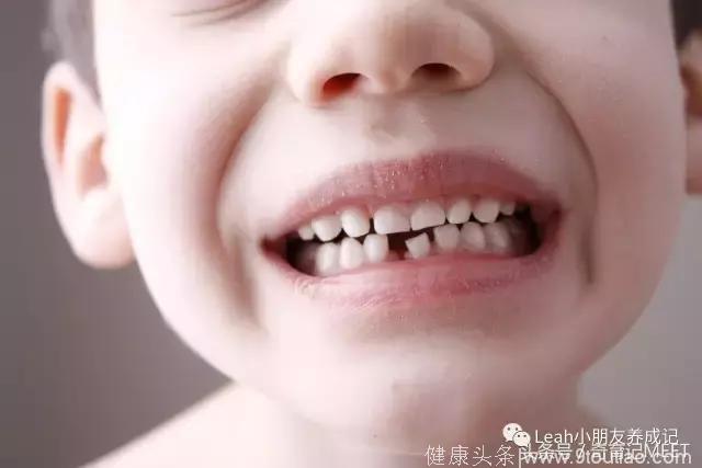 宝宝长牙那些事（二）：儿童牙齿创伤和急救