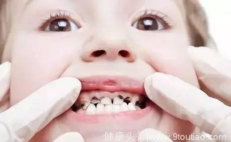 那些常见的儿童口腔护理误区，你中招了吗？