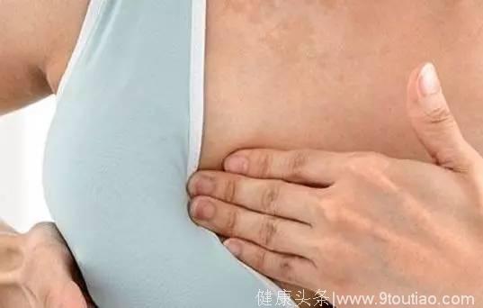 乳腺增生有哪些主要症状？它会导致乳腺癌吗？