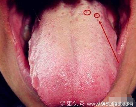 看舌头知百病，还能预示癌前病变！赶紧找镜子测试下身体健康
