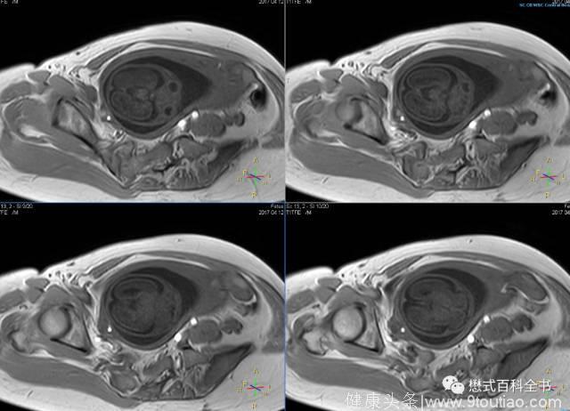 「医学类」产前（胎儿）磁共振扫描及临床应用