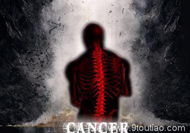 肺癌肝癌等癌症骨转移可以选择：唑来膦酸、卡博替尼、地诺单抗
