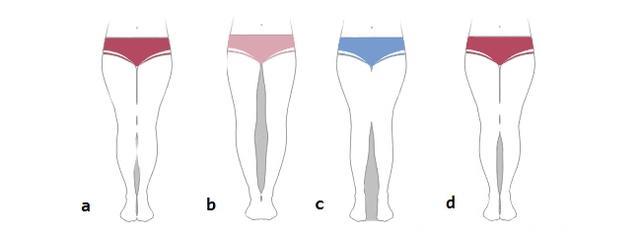 四种腿型，改善腿型不止是瘦，看看你是哪一种？