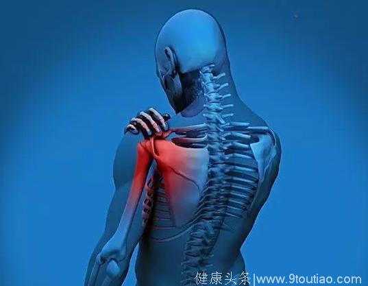 肩膀疼可能不是肩周炎，92%的人都治错病了！
