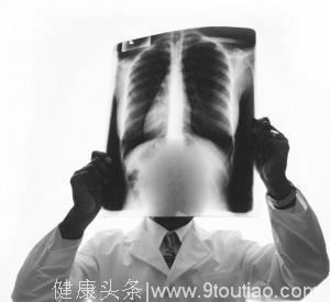 医生说自己不是算命的，也不能预判生死，不想得肺癌，远离这3种气体