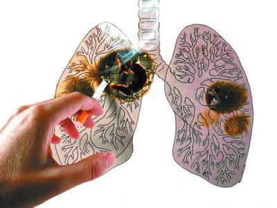 医生说自己不是算命的，也不能预判生死，不想得肺癌，远离这3种气体