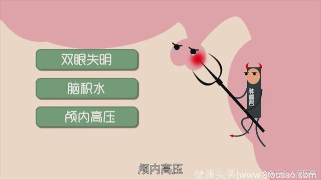 陪妻子看病自己却被查出“脑瘤”，突然变丑需警惕垂体腺瘤！