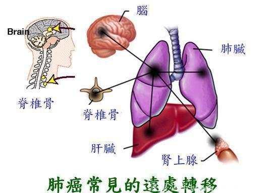 50岁患癌，8年抗癌，成功抑制癌症扩散和生长 这种果子起了了不起的作用！