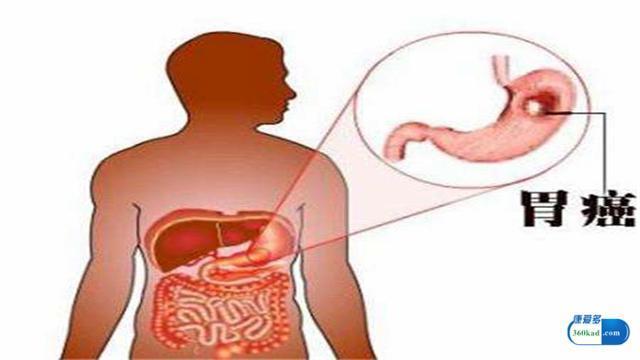 小康每日说：胃癌用药替吉奥胶囊有什么副作用吗？