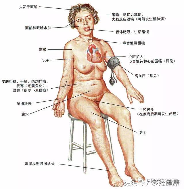 甲状腺各种发病突飞猛进谁之罪？真相怪加碘盐咯？！