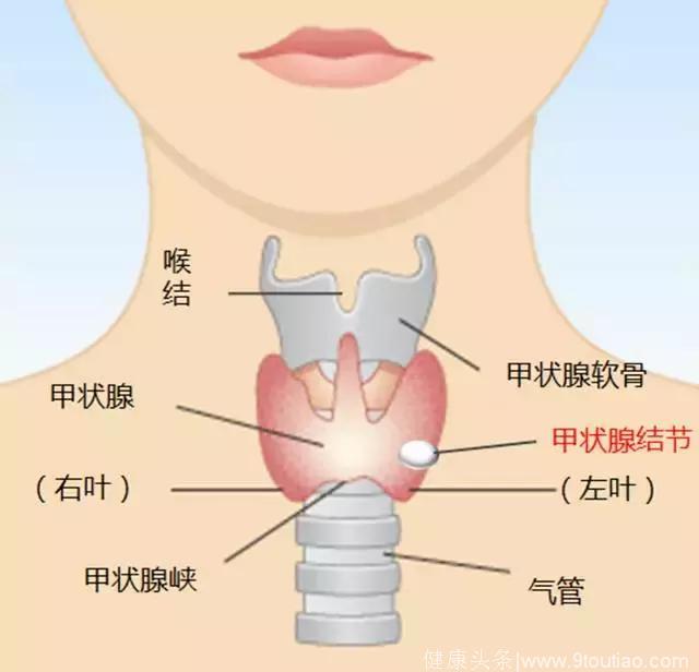 查出甲状腺结节别慌乱，辨别良恶性是关键