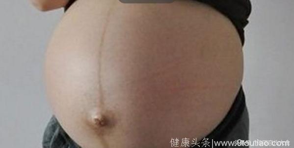 宝妈教你如何通过腹中线看胎儿性别？一看一个准！