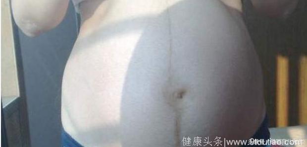 宝妈教你如何通过腹中线看胎儿性别？一看一个准！