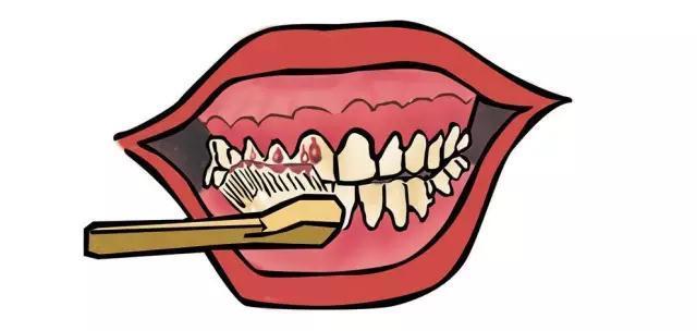 牙龈出血=体内缺少维生素C，是真的吗？