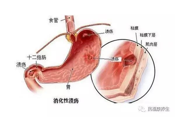 小病不治成大病 有些还会诱发癌症