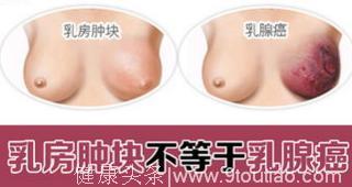 乳房肿块≠乳腺癌！一起探寻乳癌的真相