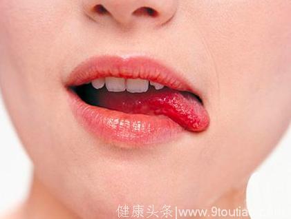 舌苔发黑竟是大病征兆