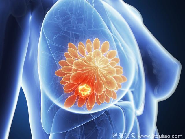胸部长出了罕见的雀斑，没想到竟是乳腺癌的信号！