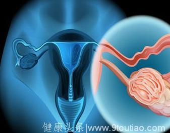 女人的克星宫颈癌，生活如何预防宫颈癌？