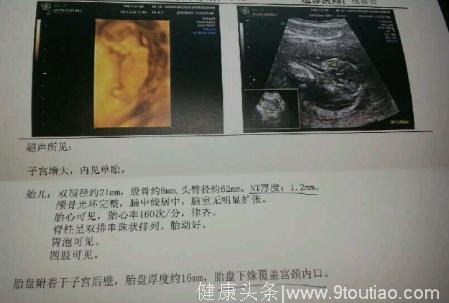 B超检查显示胎盘位置低很危险，孕妈该如何正确保胎？