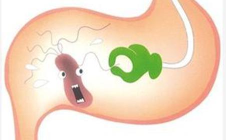 慢性胃炎久治不愈，最后真的会发展成胃癌吗？