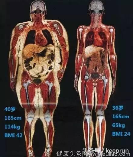 怎么区分肌肉和脂肪？15张图让你看懂脂肪与肌肉