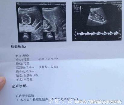 二胎生下女宝一枚，儿女双全！孕期症状和B超单分享给你，希望你也能接到好孕！