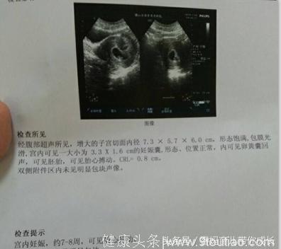 二胎生下女宝一枚，儿女双全！孕期症状和B超单分享给你，希望你也能接到好孕！
