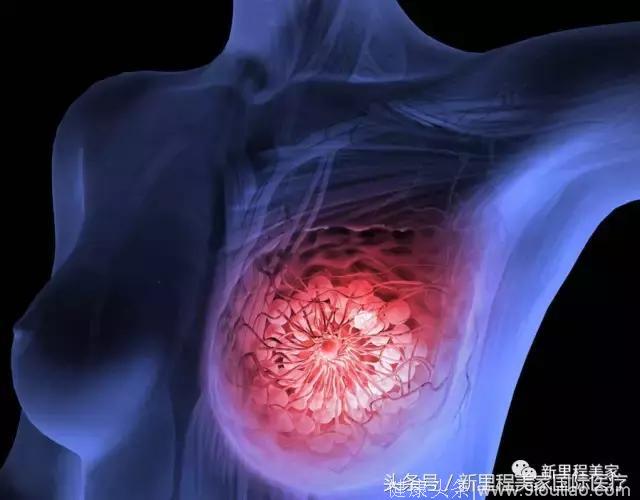 被医生告知仅有9个月的命，39岁患乳腺癌的她是如何存活25年至今健康的？
