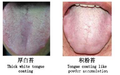 三伏天湿气重，远离七个坏习惯，加上喝这汤解暑去湿毒，你还不了解清楚？